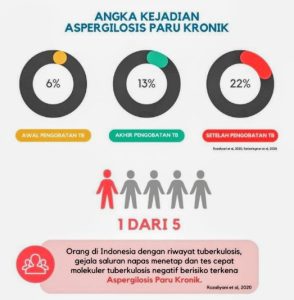 I-CHROME: Sebuah riset kolaborasi untuk penanganan Aspergilosis Paru Kronik di Indonesia