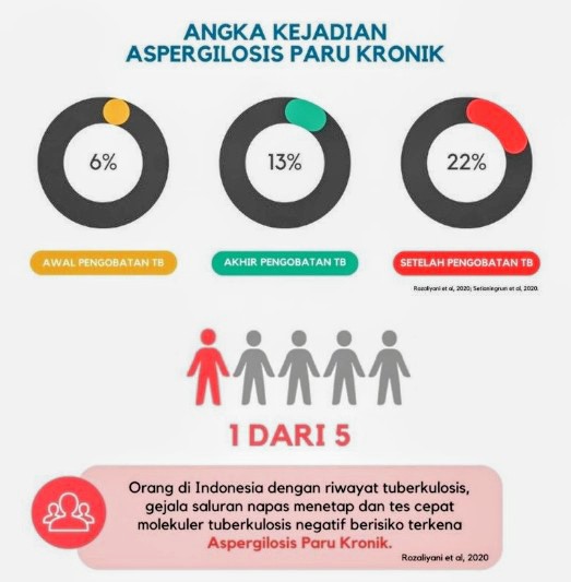 I-CHROME: Sebuah riset kolaborasi untuk penanganan Aspergilosis Paru Kronik di Indonesia